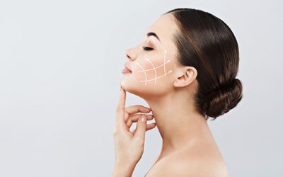 Facelift é indicado para mim?